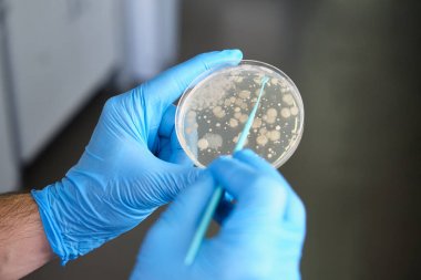 人抗心磷脂抗體IgG(ACA-IgG)ELISA Kit試劑盒/測(cè)試盒