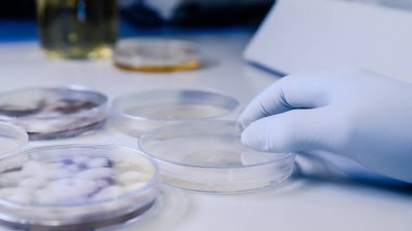 人抗增殖細胞核抗原抗體(PCNA)ELISA Kit試劑盒/測試盒
