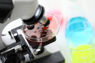 人同型半胱氨酸檢測(cè)試劑盒圖3 人同型半胱氨酸檢測(cè)試劑盒圖3